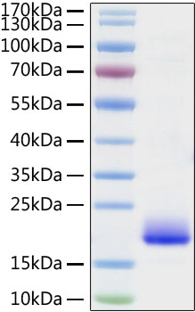 Recombinant Mouse IL-4 Protein was determined by SDS-PAGE under reducing conditions with Coomassie Blue.