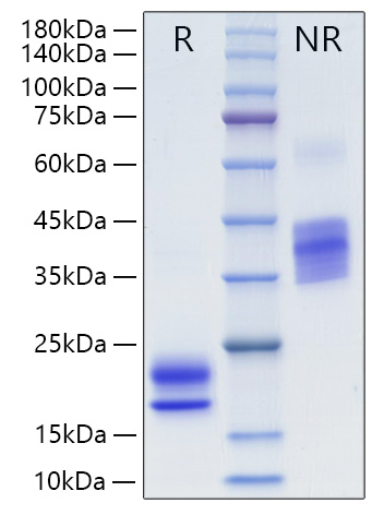 Recombinant Human VEGF-A/VEGF121 Protein was determined by SDS-PAGE under reducing (R) and non-reducing (NR) conditions.