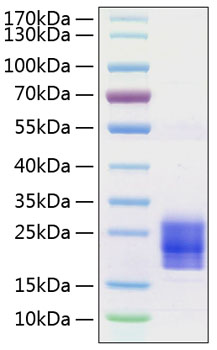 Recombinant Human/Mouse/Rat Irisin/FNDC5 Protein was determined by SDS-PAGE under reducing conditions with Coomassie Blue.