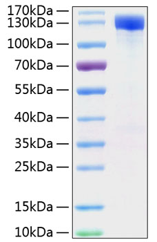 Recombinant Mouse ErbB-2/HER2/CD340 Protein was determined by SDS-PAGE under reducing conditions with Coomassie Blue.