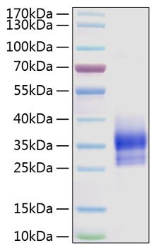 Recombinant Human Sclerostin/SOST Protein was determined by SDS-PAGE under reducing conditions with Coomassie Blue.