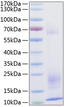 Recombinant Human TSLP Protein was determined by SDS-PAGE under reducing conditions with Coomassie Blue.