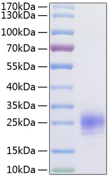 Recombinant Human TSLP(R127A,R130A) Protein was determined by SDS-PAGE under reducing conditions with Coomassie Blue.
