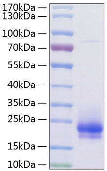 Recombinant Human Flt4 ligand/VEGF-C Protein was determined by SDS-PAGE under reducing conditions with Coomassie Blue.