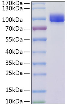 Recombinant Mouse VCAM-1/CD106 Protein was determined by SDS-PAGE under reducing conditions with Coomassie Blue.