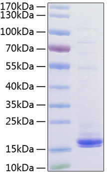 Recombinant Human CD3 epsilon Protein was determined by SDS-PAGE under reducing conditions with Coomassie Blue.