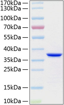 Recombinant Human Annexin A5/ANXA5 Protein was determined by SDS-PAGE under reducing conditions with Coomassie Blue.