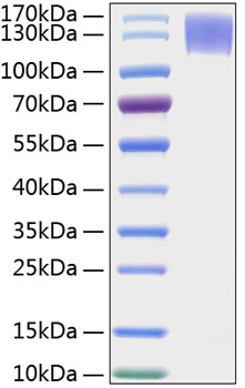 Recombinant Human MERTK Protein was determined by SDS-PAGE under reducing conditions with Coomassie Blue.