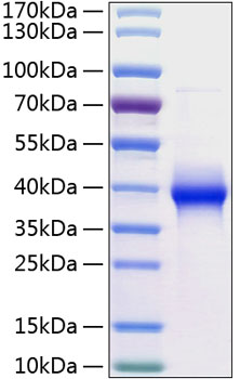 Recombinant Human LILRB4/ILT-3/CD85k Protein was determined by SDS-PAGE under reducing conditions with Coomassie Blue.