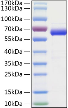 Recombinant Human Siglec-15/CD33L3 Protein was determined by SDS-PAGE under reducing conditions with Coomassie Blue.