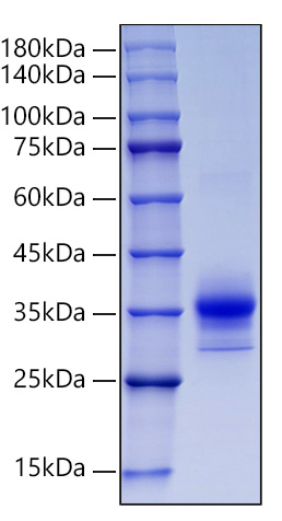 Recombinant Human LOX-1/OLR1 Protein was determined by SDS-PAGE under reducing conditions with Coomassie Blue.