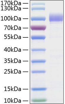 Recombinant Human Siglec-9/CD329 Protein was determined by SDS-PAGE under reducing conditions with Coomassie Blue.