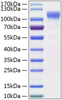 Recombinant Human LRRC4 Protein was determined by SDS-PAGE under reducing conditions with Coomassie Blue.
