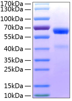 Recombinant Human ADAM8/CD156a Protein was determined by SDS-PAGE under reducing conditions with Coomassie Blue.