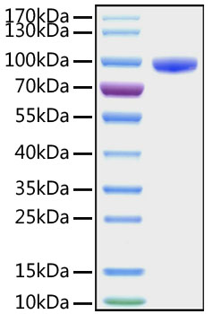 Recombinant Human CD177 Protein was determined by SDS-PAGE under reducing conditions with Coomassie Blue.