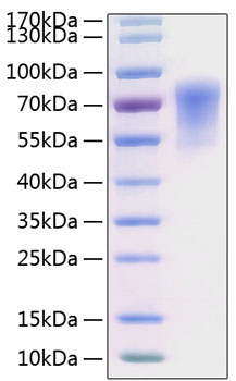 Recombinant Human CADM1/IGSF4A Protein was determined by SDS-PAGE under reducing conditions with Coomassie Blue.