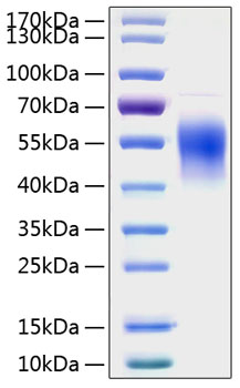 Recombinant Human IL-2RG/CD132 Protein was determined by SDS-PAGE under reducing conditions with Coomassie Blue.