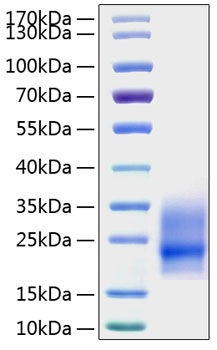 Recombinant Mouse CSF-2/GM-CSF Protein was determined by SDS-PAGE under reducing conditions with Coomassie Blue.