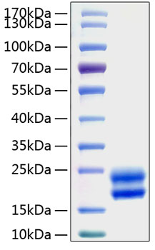 Recombinant Rat CSF-2/GM-CSF Protein was determined by SDS-PAGE under reducing conditions with Coomassie Blue.