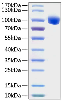Recombinant Human ROR1 Protein was determined by SDS-PAGE under reducing conditions with Coomassie Blue.