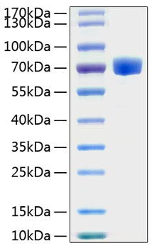 Recombinant Human EphA7/EHK-3 Protein was determined by SDS-PAGE under reducing conditions with Coomassie Blue.