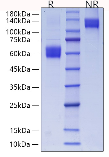Recombinant Mouse CD28 Protein was determined by SDS-PAGE under reducing (R) and non-reducing (NR) conditions.