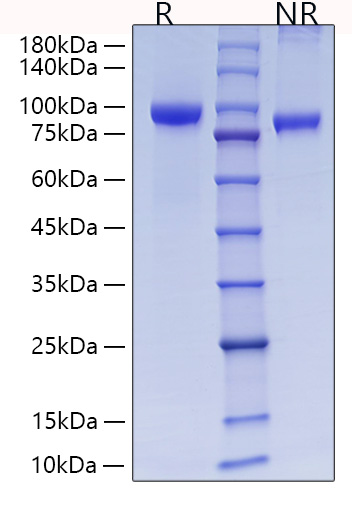 Recombinant Rat MMP-9 Protein was determined by SDS-PAGE under reducing (R) and non-reducing (NR) conditions.