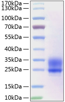 Recombinant Human Frizzled-5/FZD5 Protein was determined by SDS-PAGE under reducing conditions with Coomassie Blue.