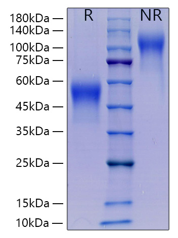 Recombinant Mouse CSF-1/M-CSF Protein was determined by SDS-PAGE under reducing (R) and non-reducing (NR) conditions.