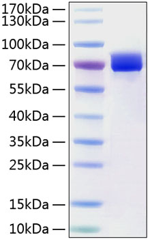 Recombinant Human Mesothelin/MSLN Protein was determined by SDS-PAGE under reducing conditions with Coomassie Blue.