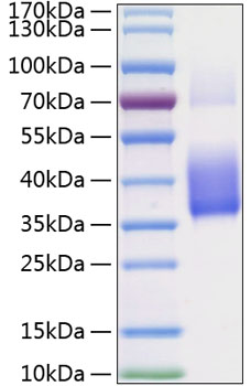 Recombinant Human CSF-1/M-CSF Protein was determined by SDS-PAGE under reducing (R) and non-reducing (NR) conditions.