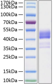 Recombinant Human TNFRSF13C/BAFFR/CD268 Protein was determined by SDS-PAGE under reducing conditions with Coomassie Blue.