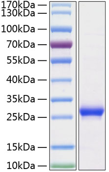 Recombinant Rat Lipocalin-2/NGAL/LCN2 Protein was determined by SDS-PAGE under reducing conditions with Coomassie Blue.