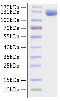 Recombinant Mouse VCAM-1/CD106 Protein was determined by SDS-PAGE under reducing conditions with Coomassie Blue.