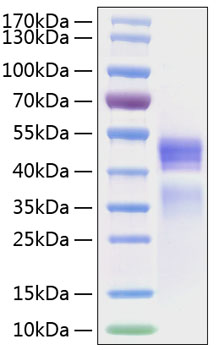 Recombinant Human IL-12/IL-12A&amp;IL-12B Protein was determined by SDS-PAGE under reducing conditions with Coomassie Blue.