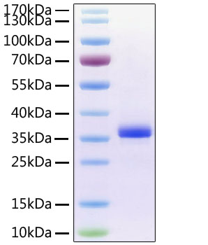 Recombinant Human Noggin/NOG Protein was determined by SDS-PAGE under reducing conditions with Coomassie Blue.