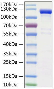 Recombinant Human Semaphorin-4A/SEMA4A Protein was determined by SDS-PAGE under reducing conditions with Coomassie Blue.