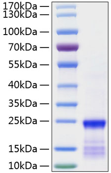 Recombinant Human GTPase KRas/KRAS(G12V) Protein was determined by SDS-PAGE under reducing conditions with Coomassie Blue.