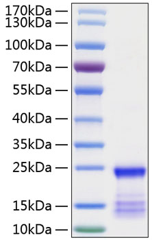 Recombinant Human GTPase KRas/KRAS Protein was determined by SDS-PAGE under reducing conditions with Coomassie Blue.