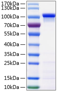 Recombinant Human Catenin beta-1/CTNNB1 Protein was determined by SDS-PAGE under reducing conditions with Coomassie Blue.