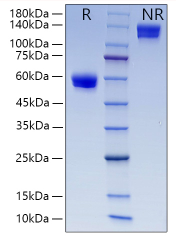 Recombinant Human CD8a Protein was determined by SDS-PAGE under reducing (R) and non-reducing (NR) conditions.