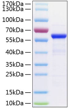 Recombinant Human TET2 Protein was determined by SDS-PAGE under reducing conditions with Coomassie Blue.