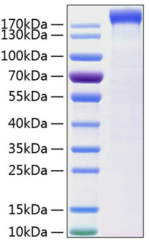 Recombinant Human Leptin receptor/LEP-R/CD295 Protein was determined by SDS-PAGE under reducing conditions with Coomassie Blue.