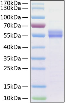 Recombinant Human IL-15 Protein was determined by SDS-PAGE under reducing conditions with Coomassie Blue.