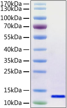 Recombinant SARS-CoV-2 Envelope Protein was determined by SDS-PAGE under reducing conditions with Coomassie Blue.