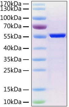 Recombinant SARS-CoV-2 Nucleocapsid Protein was determined by SDS-PAGE under reducing conditions with Coomassie Blue.