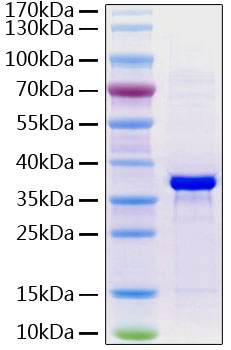 Recombinant Human Fibrinogen like 1/FGL1 Protein was determined by SDS-PAGE under reducing conditions with Coomassie Blue.
