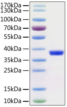 Recombinant SARS-CoV-2 3C-like Proteinase Protein was determined by SDS-PAGE under reducing conditions with Coomassie Blue.