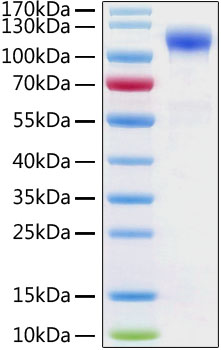 Recombinant Human ACE-2 Protein was determined by SDS-PAGE under reducing conditions with Coomassie Blue.