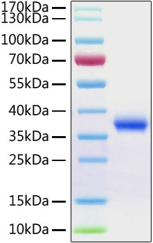 Recombinant SARS-CoV-2 Spike RBD Protein was determined by SDS-PAGE under reducing conditions with Coomassie Blue.